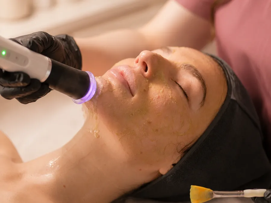 Microdermabrasion in progress