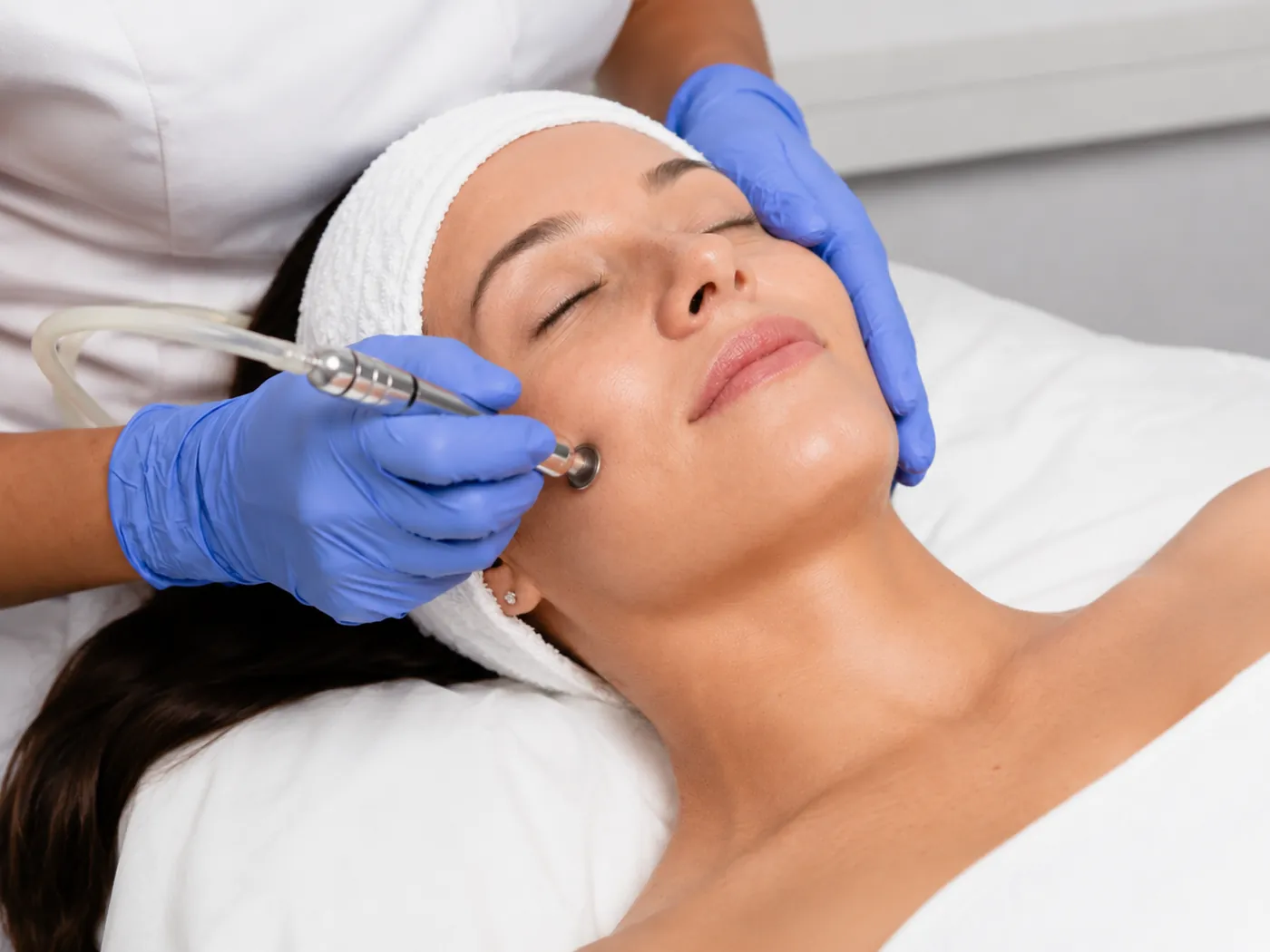 Microdermabrasion